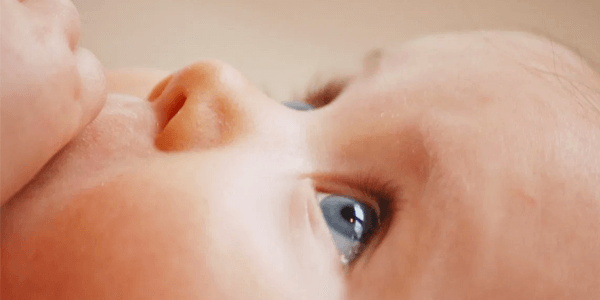 Obstrução lacrimal em recém-nascidos